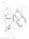 Fig. 02 - Device for single handled injection of an intraocular lens