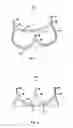 Fig. 02 - Non-axisymmetric aortic valve devices
