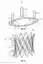 Fig. 08 - Non-axisymmetric aortic valve devices
