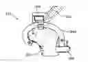 Fig. 01 - Ethnic-specific orthopaedic implants and custom cutting jigs