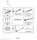 Fig. 04 - Ethnic-specific orthopaedic implants and custom cutting jigs