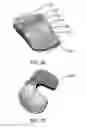 Fig. 28 - Ethnic-specific orthopaedic implants and custom cutting jigs