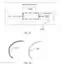 Fig. 43 - Ethnic-specific orthopaedic implants and custom cutting jigs