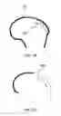 Fig. 44 - Ethnic-specific orthopaedic implants and custom cutting jigs