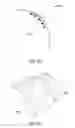 Fig. 48 - Ethnic-specific orthopaedic implants and custom cutting jigs