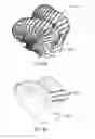 Fig. 50 - Ethnic-specific orthopaedic implants and custom cutting jigs