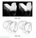 Fig. 64 - Ethnic-specific orthopaedic implants and custom cutting jigs