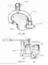 Fig. 72 - Ethnic-specific orthopaedic implants and custom cutting jigs