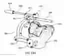 Fig. 74 - Ethnic-specific orthopaedic implants and custom cutting jigs