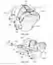 Fig. 75 - Ethnic-specific orthopaedic implants and custom cutting jigs