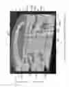 Fig. 05 - Spinal implant and methods of manufacture thereof