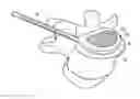 Fig. 01 - In-situ formed intervertebral fusion device and method