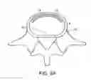 Fig. 03 - In-situ formed intervertebral fusion device and method