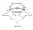 Fig. 07 - In-situ formed intervertebral fusion device and method