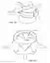 Fig. 08 - In-situ formed intervertebral fusion device and method