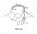 Fig. 17 - In-situ formed intervertebral fusion device and method