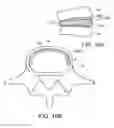 Fig. 18 - In-situ formed intervertebral fusion device and method