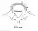 Fig. 22 - In-situ formed intervertebral fusion device and method