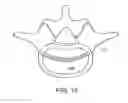 Fig. 27 - In-situ formed intervertebral fusion device and method