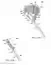 Fig. 29 - In-situ formed intervertebral fusion device and method