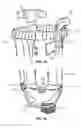 Fig. 09 - MODULAR PROSTHETIC SOCKETS AND METHODS FOR MAKING SAME