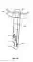 Fig. 14 - MODULAR PROSTHETIC SOCKETS AND METHODS FOR MAKING SAME