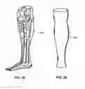 Fig. 16 - MODULAR PROSTHETIC SOCKETS AND METHODS FOR MAKING SAME