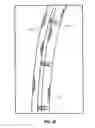 Fig. 19 - MODULAR PROSTHETIC SOCKETS AND METHODS FOR MAKING SAME