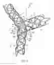 Fig. 09 - SELF-EXPANDING BIFURCATED STENT