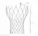 Fig. 01 - Stent and securely-installed artificial valve replacement device having same