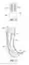 Fig. 13 - Circumferential walker