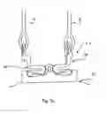 Fig. 07 - Wheelchair comprising energy absorber