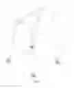 Fig. 02 - Walking aid