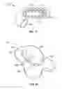 Fig. 12 - DEVICES AND METHODS FOR PROMOTING FEMALE SEXUAL WELLNESS