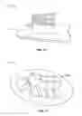 Fig. 15 - DEVICES AND METHODS FOR PROMOTING FEMALE SEXUAL WELLNESS
