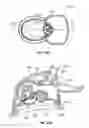 Fig. 24 - DEVICES AND METHODS FOR PROMOTING FEMALE SEXUAL WELLNESS