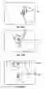 Fig. 29 - DEVICES AND METHODS FOR PROMOTING FEMALE SEXUAL WELLNESS