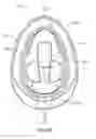 Fig. 41 - DEVICES AND METHODS FOR PROMOTING FEMALE SEXUAL WELLNESS