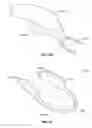Fig. 52 - DEVICES AND METHODS FOR PROMOTING FEMALE SEXUAL WELLNESS