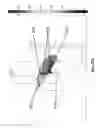 Fig. 71 - Shock wave applicator with movable electrode