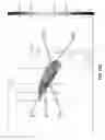 Fig. 79 - Shock wave applicator with movable electrode