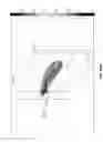 Fig. 83 - Shock wave applicator with movable electrode