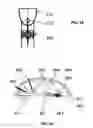 Fig. 85 - Shock wave applicator with movable electrode
