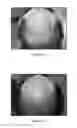 Fig. 02 - METHOD FOR PROMOTING HAIR GROWTH