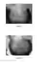 Fig. 03 - METHOD FOR PROMOTING HAIR GROWTH