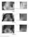 Fig. 04 - METHOD FOR PROMOTING HAIR GROWTH