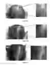 Fig. 06 - METHOD FOR PROMOTING HAIR GROWTH
