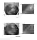 Fig. 07 - METHOD FOR PROMOTING HAIR GROWTH