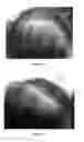 Fig. 09 - METHOD FOR PROMOTING HAIR GROWTH