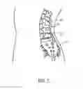 Fig. 03 - Compositions and methods for treating post-operative pain using clonidine and bupivacaine